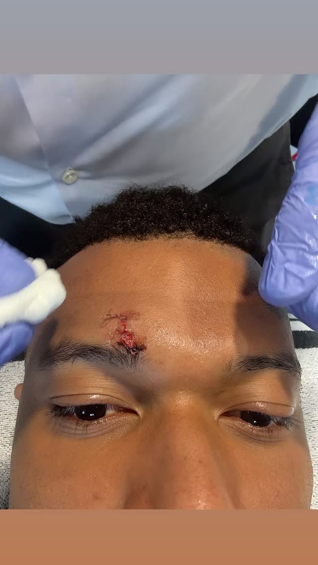 Mbappé, el héroe herido: Real Madrid y Girona empatan en un duelo polémico