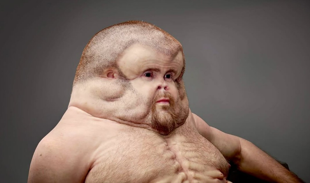 Graham: El Humano Que Podría Sobrevivir a un Accidente de Coche