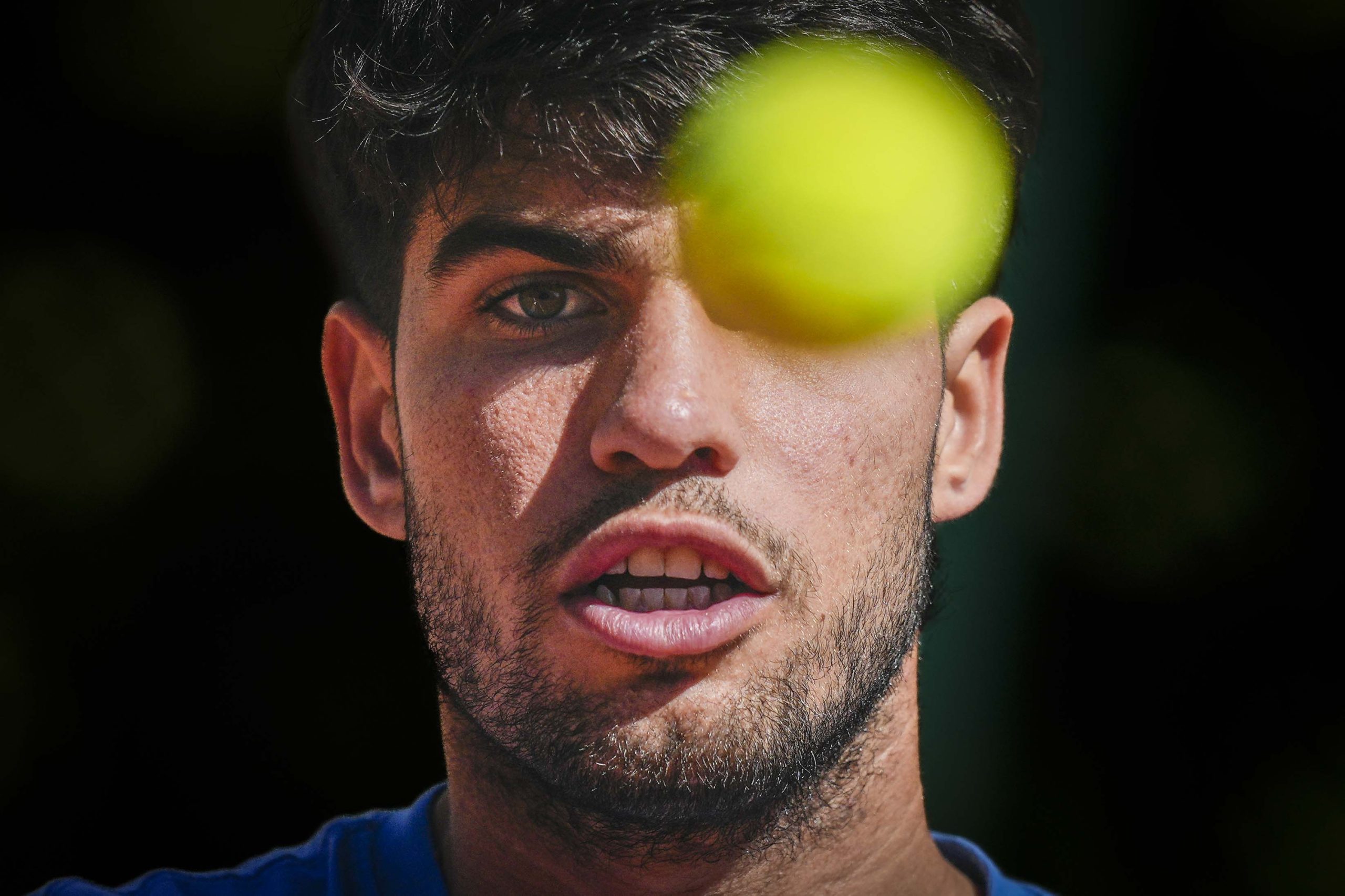 Alcaraz Dice Adiós a Roma y Roland Garros: La Sombra de la Férula y las Predicciones de Mouratoglou