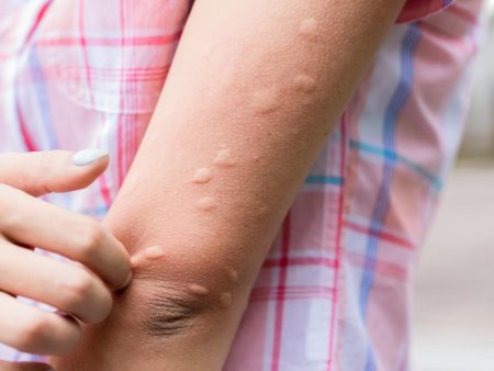 El truco definitivo para librarte de los mosquitos en verano: así debes utilizar la canela según la experiencia de esta abuela