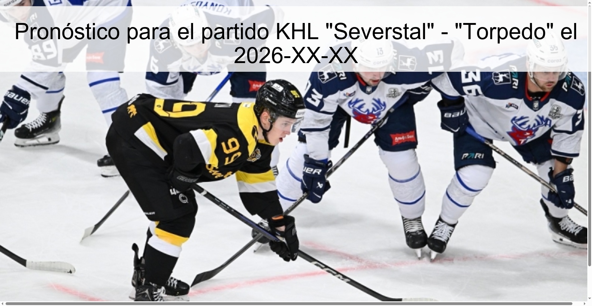 Forecast For The Match KHL “Severstal”
